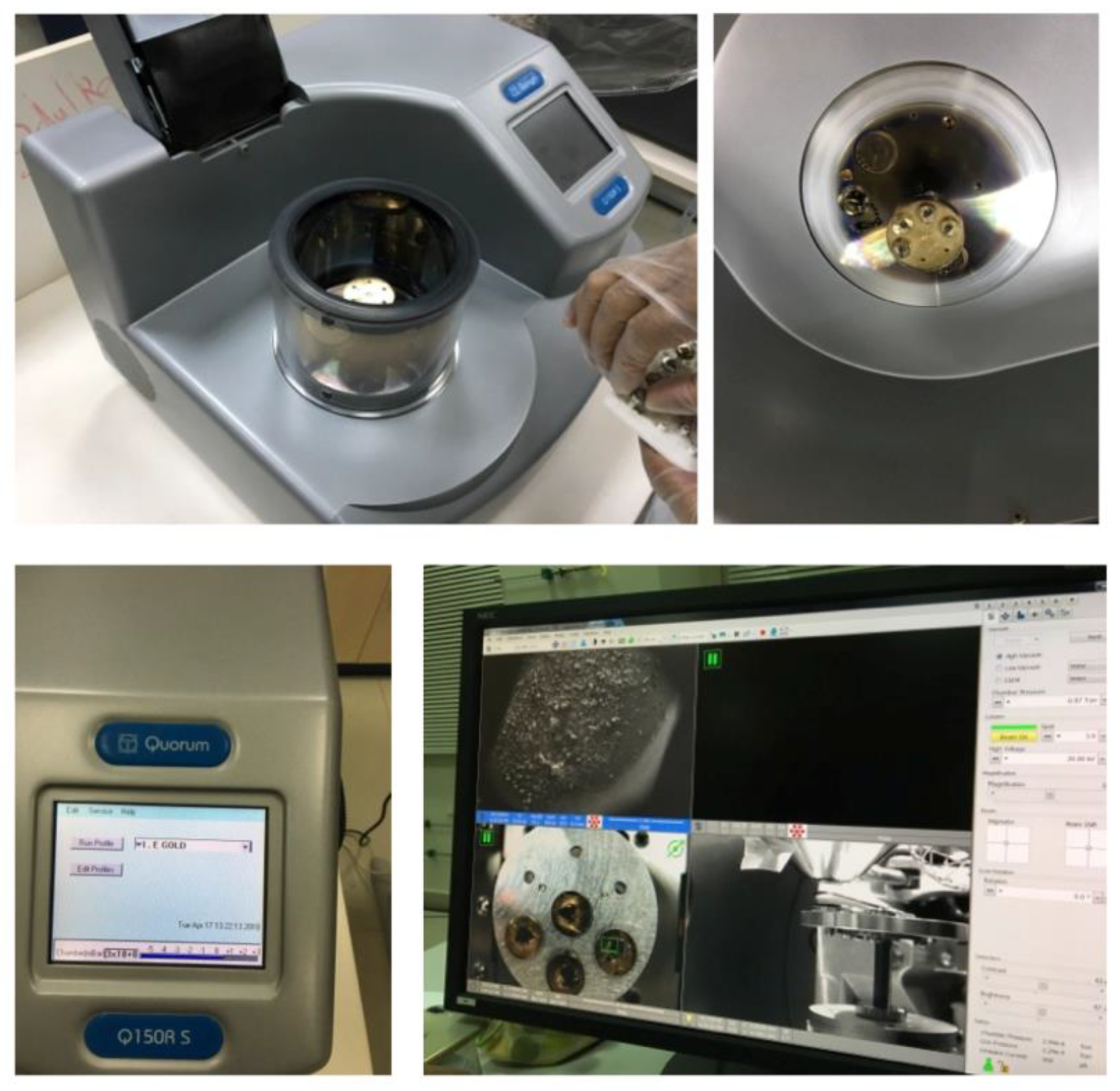 The scanning electron microscope (SEM) test.