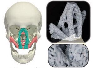 Bio-Inspired Sturdy, Lightweight Porous Materials for Bone Implants and Aircraft.