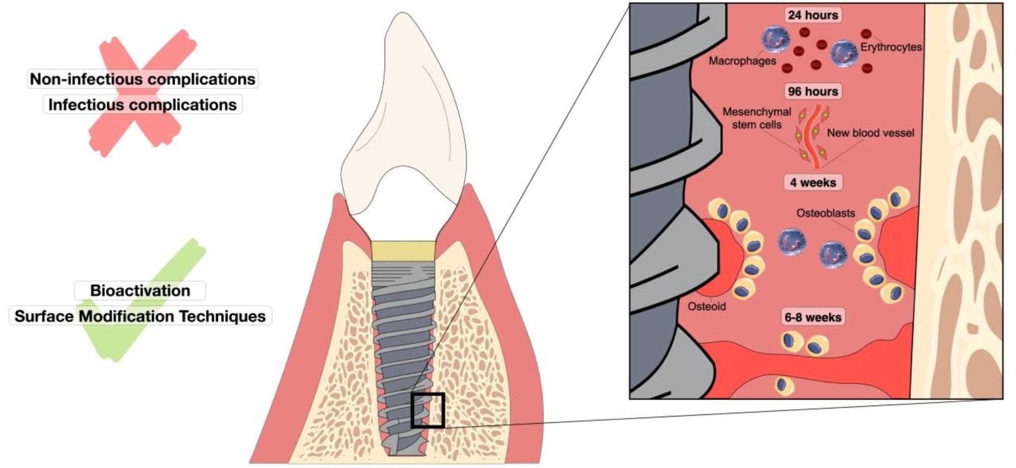 Representation of oral osseointegration events over time in a dental implant. The figure shows the sequence of cellular-level responses that occur after implant insertion for 24 h to approximately 8 weeks. Non-infectious and infectious complications are reported as factors that hinder osseointegration. Factors that improve this process are bioactivation and surface modification techniques.