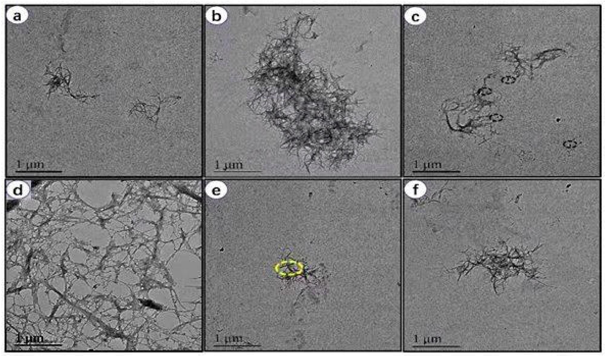 TEM images of lignocellulosic nanofibers (LCNFs): (a) TEM image of raw sisal fiber without phosphoric acid treatment. (b–e) TEM micrograph of nanofiber after treatment with phosphoric acid. The size of nanofiber is reduced significantly from micrometer to nanometer range. (f) Magnified view of selected yellow circle area from panel (e).