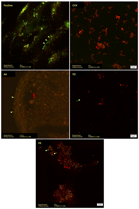 LIVE/DEAD staining analyzed with confocal microscope of Vivera® retainer. Living cells stained with SYTO9 are indicated with green arrows. Dead cells stained with PI are indicated with red arrows.