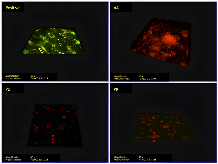 Vivera® retainer 3D imaging analyzed with confocal microscope. Living cells stained with SYTO9 are indicated with green arrows. Dead cells stained with PI are indicated with red arrows.