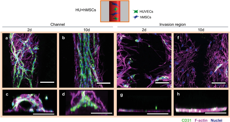 Cellular arrangement of HUVECs and hMSCs printed in proximity in the channel (Group HU+hMSCs). a) Representative confocal images of the channel with HUVECs (green) forming vascular structures as early as 2 days post printing. hMSCs (magenta) in proximity spanning in between newly forming vascular structures. b) Representative confocal image after 10 days showing more mature microvascular structures, with a constant diameter and hMSCs aligning with the strongly oriented vascular structures along the channel direction. c) Representative front view image of the channel 2 days after printing with cells initially attach to channel surface. d) Representative front view image of the channel 10 days after printing completely filled by cells. e,f) Representative images of the invasion region 2 and 10 days after printing with little immigration of HUVECs, but strong immigration of hMSCs from the channel. g,h) Front view reconstructions of the invasion region 2 and 10 days after printing with no cells penetrating the bulk material. Samples were stained for CD31 (HUVECs, green), nuclei (blue) and F-actin (hMSCs and HUVECs, magenta). Scale bars: a,b,e,f) 50 µm, c,d,g,h) 200 µm.