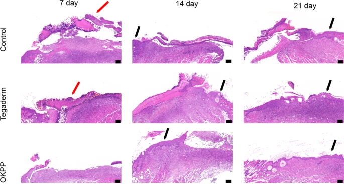 H&E staining of wound tissue on days 7, 14, and 21.