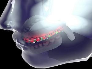 Smart Dental Aids Use Flexible Batteries