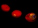 Development in Advanced Microscopy Techniques Shows Scientist How Malaria Attack Red Blood Cells