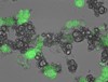 Researchers Design Nanoparticles Capable of Synthesizing Proteins at Tumor Sites