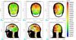 Supercomputer Simulations of Traumatic Brain Injury Help Design Better Helmets