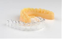 Stratasys, Ltd. to Offer Orthodontic Labs a Digital Solution