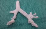 Bioresorbable Splint Made Using 3D Printing Process Saves Baby’s Life