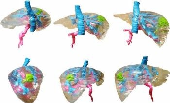 Researchers Successfully 3D Print Preoperative Planning Model of Human Liver