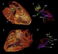 Researchers Use 3D Data to Understand Cardiac Conduction System