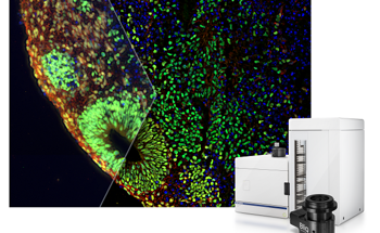 SLIDEVIEW™ VS200 Adds Optical Sectioning Device for High-Contrast, Blur-Free Imaging