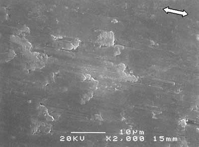 AZoJoMo - AZoM Journal of Materials Online - SEM micrographs of the worn surface of monolithic alumina (a) and alumina - 5 vol% silicon carbide nanocomposites (b-e) sintered at various temperatures 1700oC.