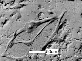 AZoJomo - The AZO Journal of Materials Online - SEM picture showing attachment of the osteoblast cells on the HA coating