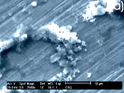 AZojomo - The "AZo Journal of Materials Online" Chemically-treated Co alloy sample.  (a) SEM image